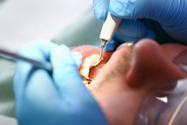 Best Emergency Denture Repair in East Valley, NV